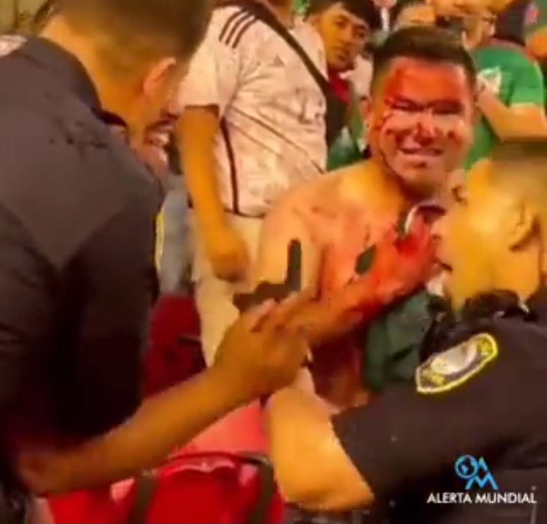 Agreden A Aficionado Mexicano Con Arma Blanca En La Copa Oro